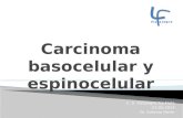 Carcinoma basocelular y espinocelular