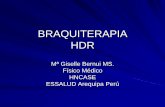 Braquiterapia HDR