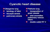 Cyanotic heart disease   tof