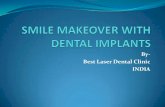 DENTAL IMPLANT FOR PENSIONERS IN INDIA