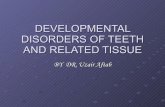 Developmental disorders of teeth and related tissue