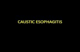 Caustic esophagitis