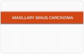 Maxillary sinus carcinoma