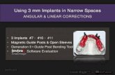 10 3 mm implants in narrow space angular & linear corrections