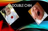 COMPLICATION & TREATMENTS FOR DOUBLE CHIN @ CHENNAI PLASTIC SURGERY