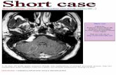 Short case...Cerebellopontine angle meningioma