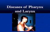 Diseases of-pharynx-and-larynx