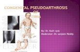 Congenital pseudoarthrosis