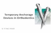 Temporary anchorage devices in orthodontics