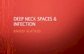 Deep neck spaces and infection ENT