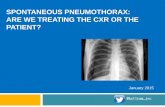 Spontaneous pneumothorax: Are we treating the patient or the xray?