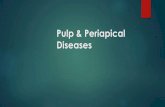 Periapical and pulp diseases