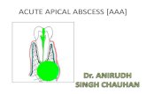 Acute apical abscess   dr anirudh singh chauhan