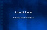 Lateral Sinus