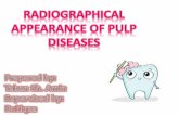 Radio pulp diseases
