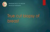 core biopsy of breast