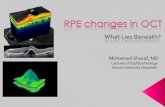 RPE changes in OCT