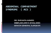 Abdominal compartment syndrome (acs )