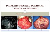 Primary neurectoermal tumor of kidney