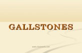 Doss India - Gall Stones, Gall Bladder Surgery  Treatment in Pune, Maharashtra