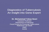 Diagnostics of tuberculosis: An insight into Genexpert 27 4-15