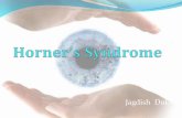 Horners syndrome