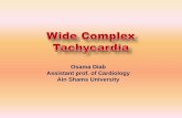 Wide complex tachycardia