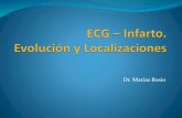 Electrocardiograma (ECG) en Infarto de Miocardio (IAM) - Dr. Bosio