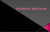 distrofia muscular