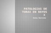 Patologia de rayos x de totax