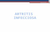 Artritis infecciosa