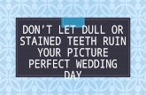 Don’t Let Dull Or Stained Teeth Ruin Your Wedding Day