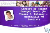 Porcelain Veneers – Correct or Repair Damaged Teeth (Dr. Thomas C. Delaney – Wentzville MO Dentist)