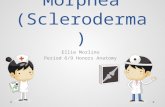 Morphea (scleroderma)