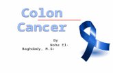 Cancer colon