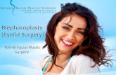 Blepharoplasty| Eyelid Surgery in Newport Beach, CA