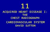 11 acquired heart disease i