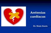 Arritmias cardiacas