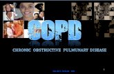 COPD BLOK 12 2011.pptx