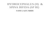 HYDROCEPHALUS _ SPINA BIFIDA.ppt