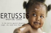 Pertussis or Whooping cough  powerpoint