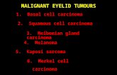 Mata Malignant Eyelid Tumours