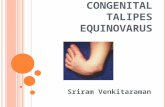 Congenital Talipes Equinovarus Final