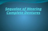Sequalae of Wearing Complete Dentures