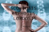 Scoliosis, Kyphosis,Lordosis