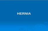 Hernia - Anatomy