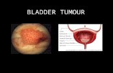 Bladder Tumour