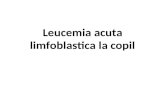 leucemia acuta limfoblastica