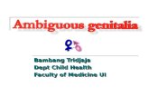 Sex Ambigus Dr Bambang Tridjaja