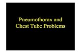 Pneumothorax 44